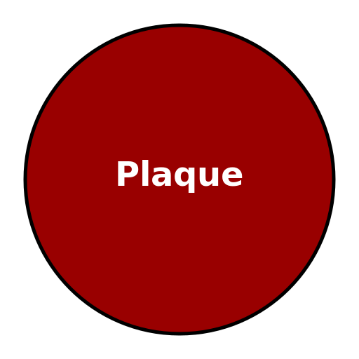 Coronary Plaque - DrawGPT