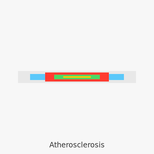 Atherosclerosis - The Art of Healthy Arteries - DrawGPT