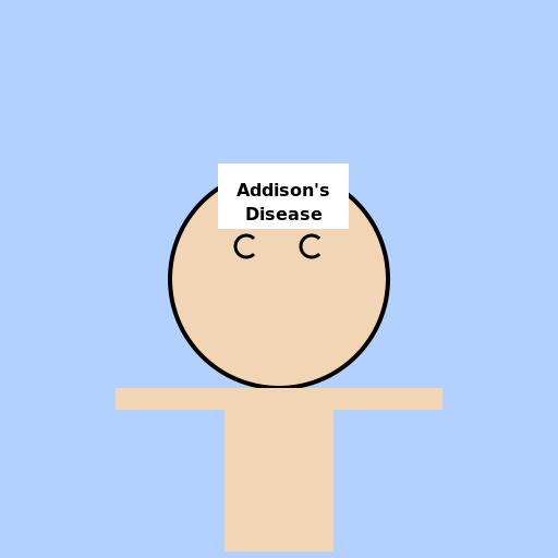 The Struggles of Addison's Disease - DrawGPT