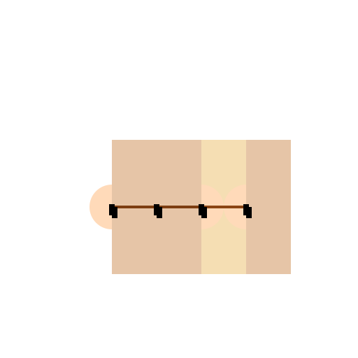 Hand in Lumbrical Plus Position - DrawGPT