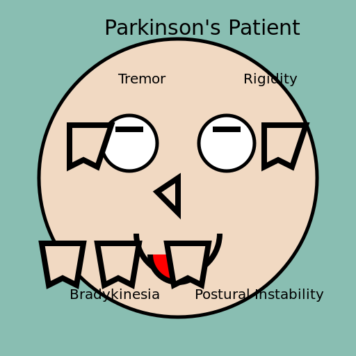 Parkinson's Patient Showing Symptoms - DrawGPT