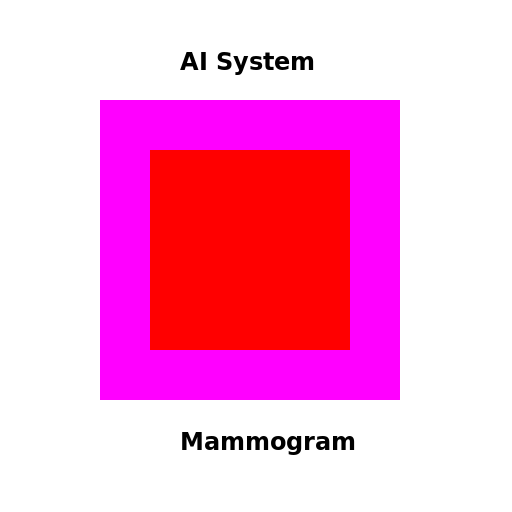 AI System Mammogram Interpretation - DrawGPT