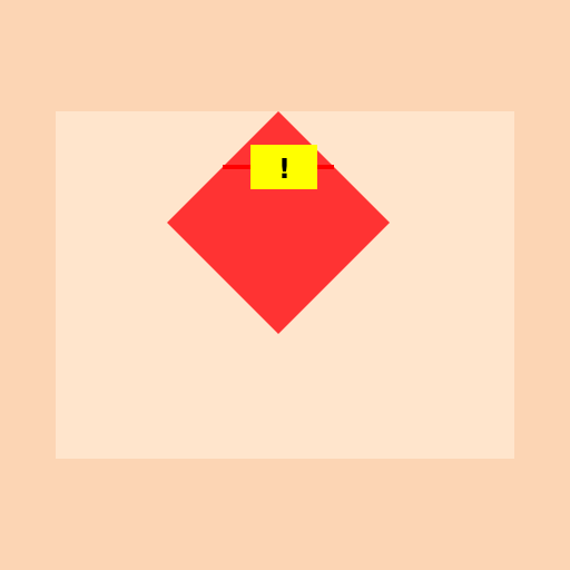 Squamous Cell Carcinoma Invasion - DrawGPT