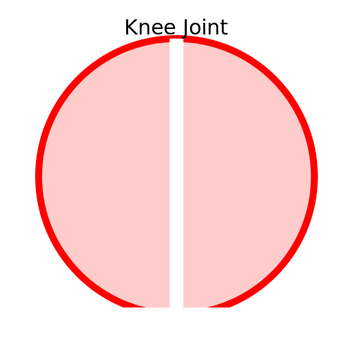 Knee Joint - DrawGPT