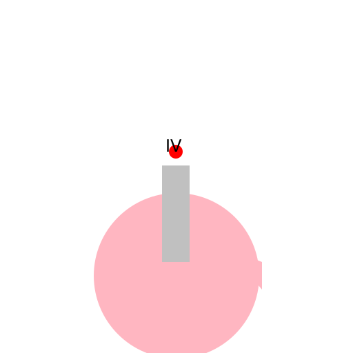 Starting an IV - DrawGPT