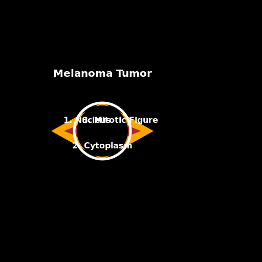Melanoma Tumor with Detailed Labels - AI Prompt #22516 - DrawGPT