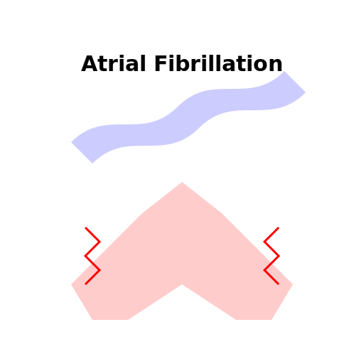 Atrial Fibrillation - An Electrical Storm in the Heart - AI Prompt #27077 - DrawGPT
