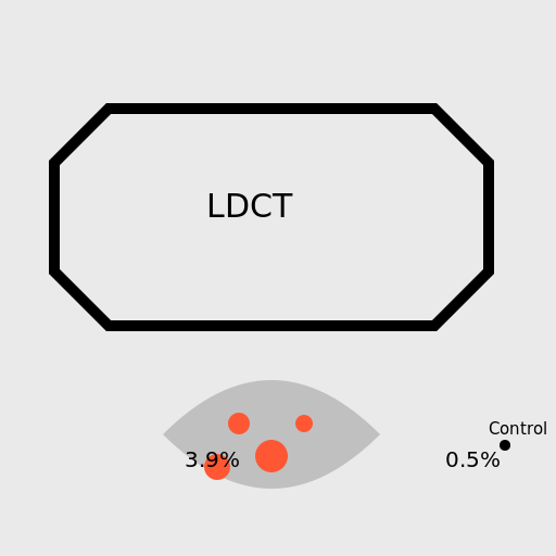 LDCT and Lung Cancer - DrawGPT