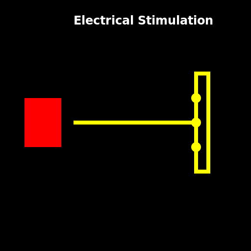 Electrical Stimulation - DrawGPT